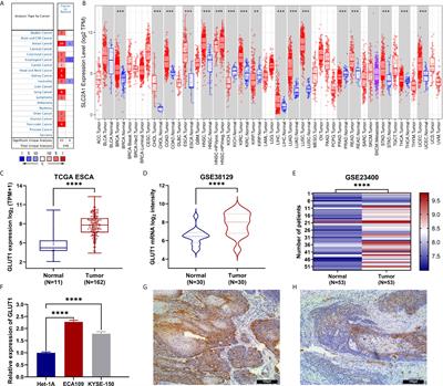 Comprehensive Analysis of GLUT1 Immune Infiltrates and ceRNA Network in Human <mark class="highlighted">Esophageal Carcinoma</mark>